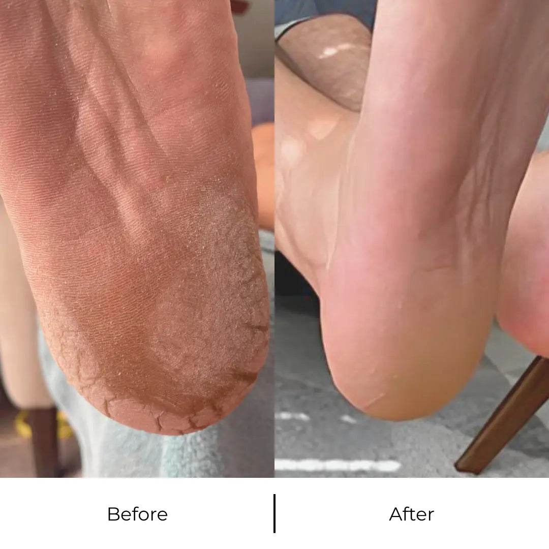 PediSoft™ Electric Foot File