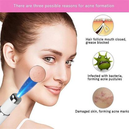  Acne laser anti wrinkle pen review