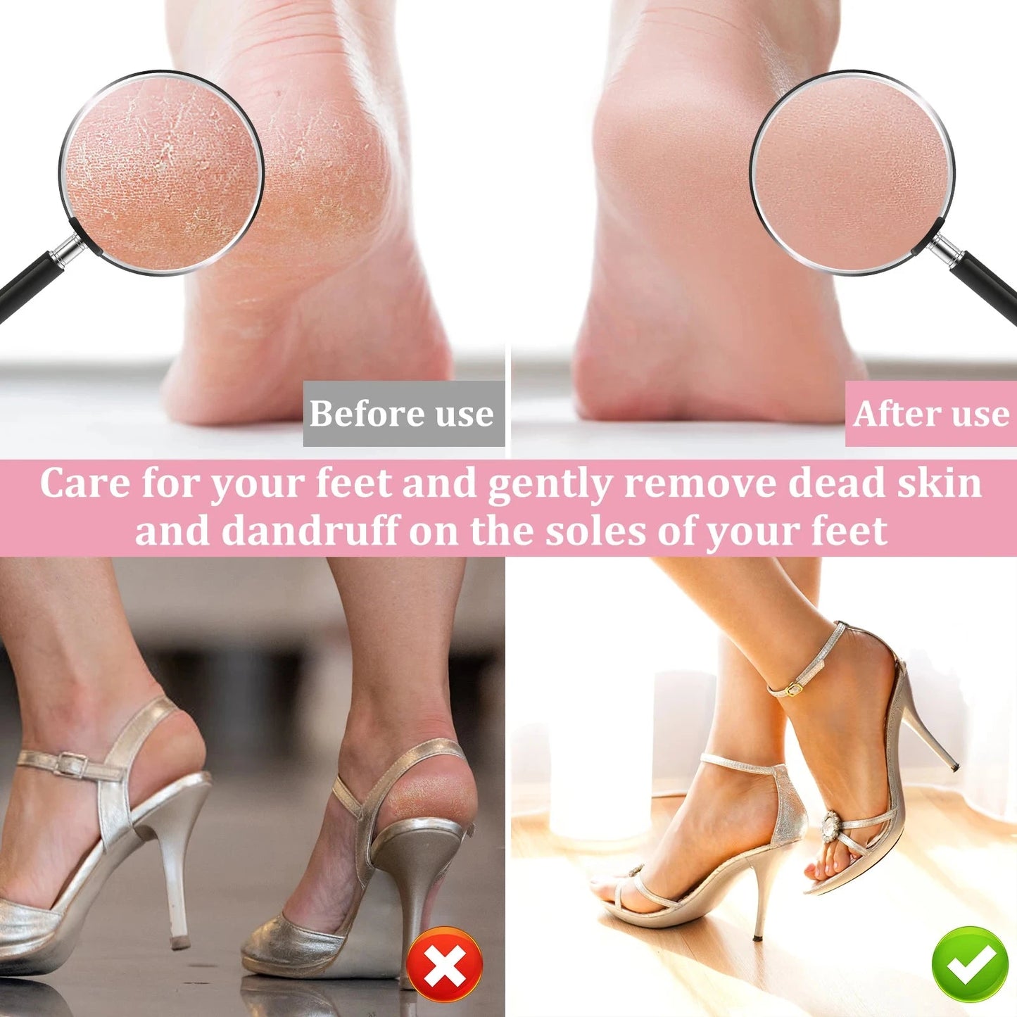 Before and after using the electric callus remover 