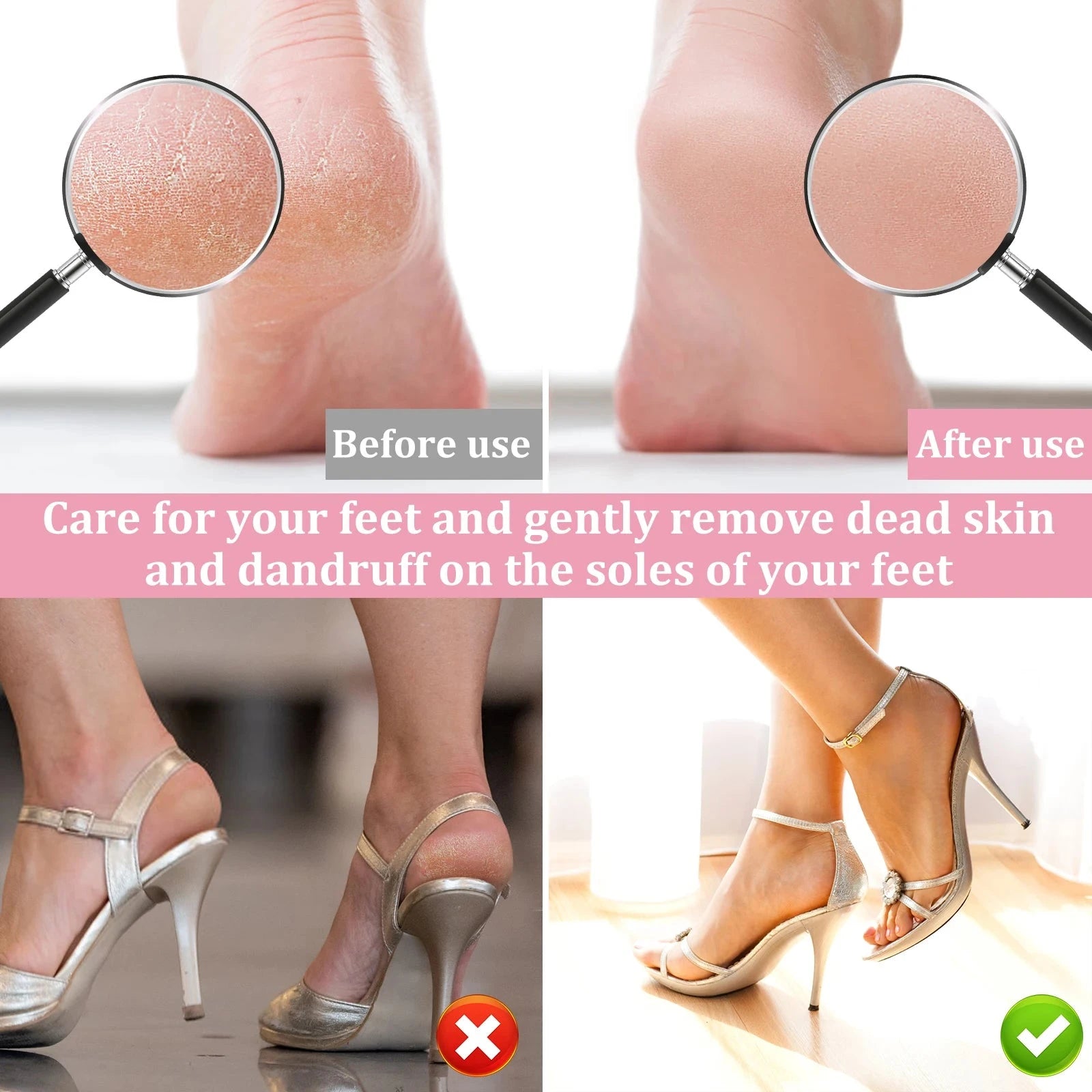 Before and after using the electric callus remover 
